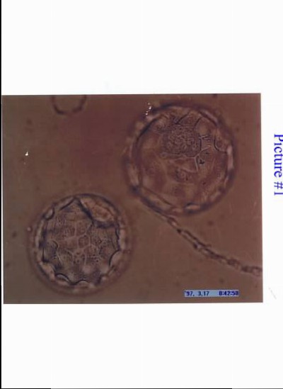 2embryos